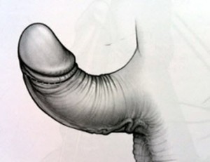 Curvatura de pene 1